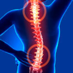 Ernia del disco: attenzione a interpretare il risultato diagnostico!
