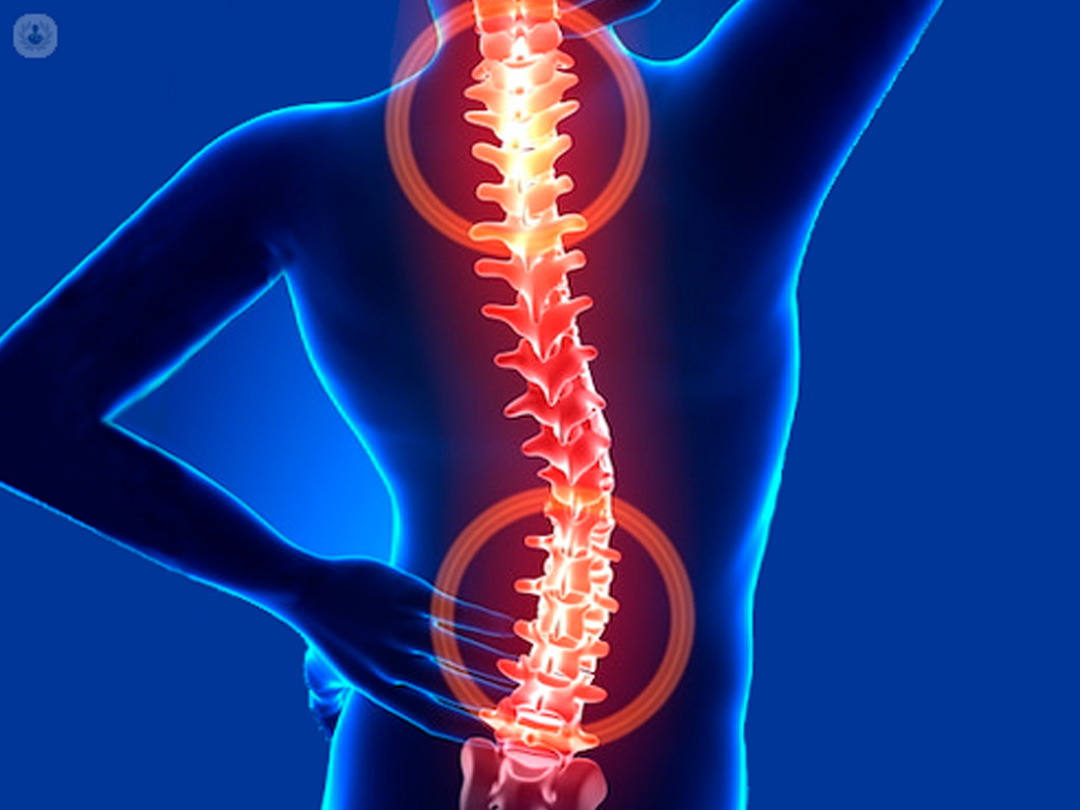 Ernia del disco: attenzione a interpretare il risultato diagnostico!